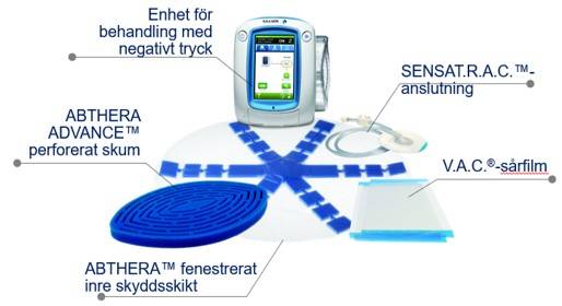 Abthera system för behandling med negativt tryck för öppen buk